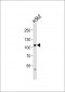 EIF4G2 Antibody (N-term)